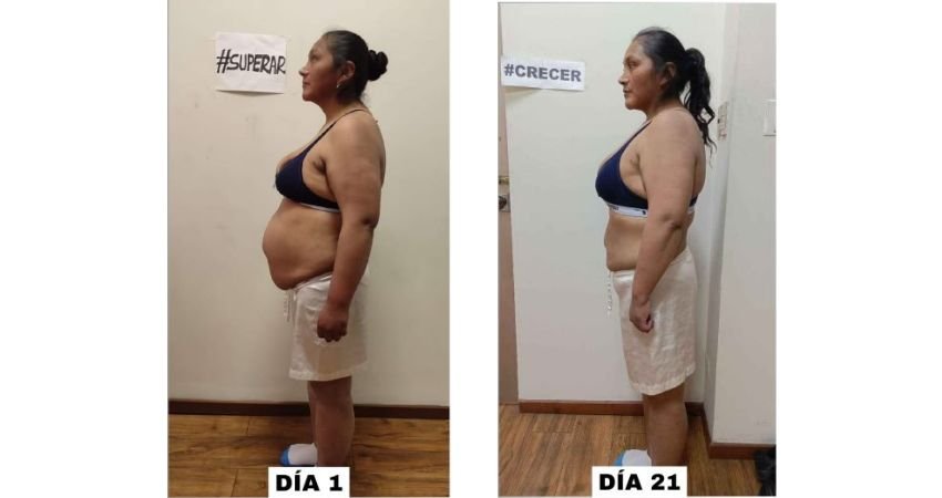 Antes y después plan Herbalife Chile 6